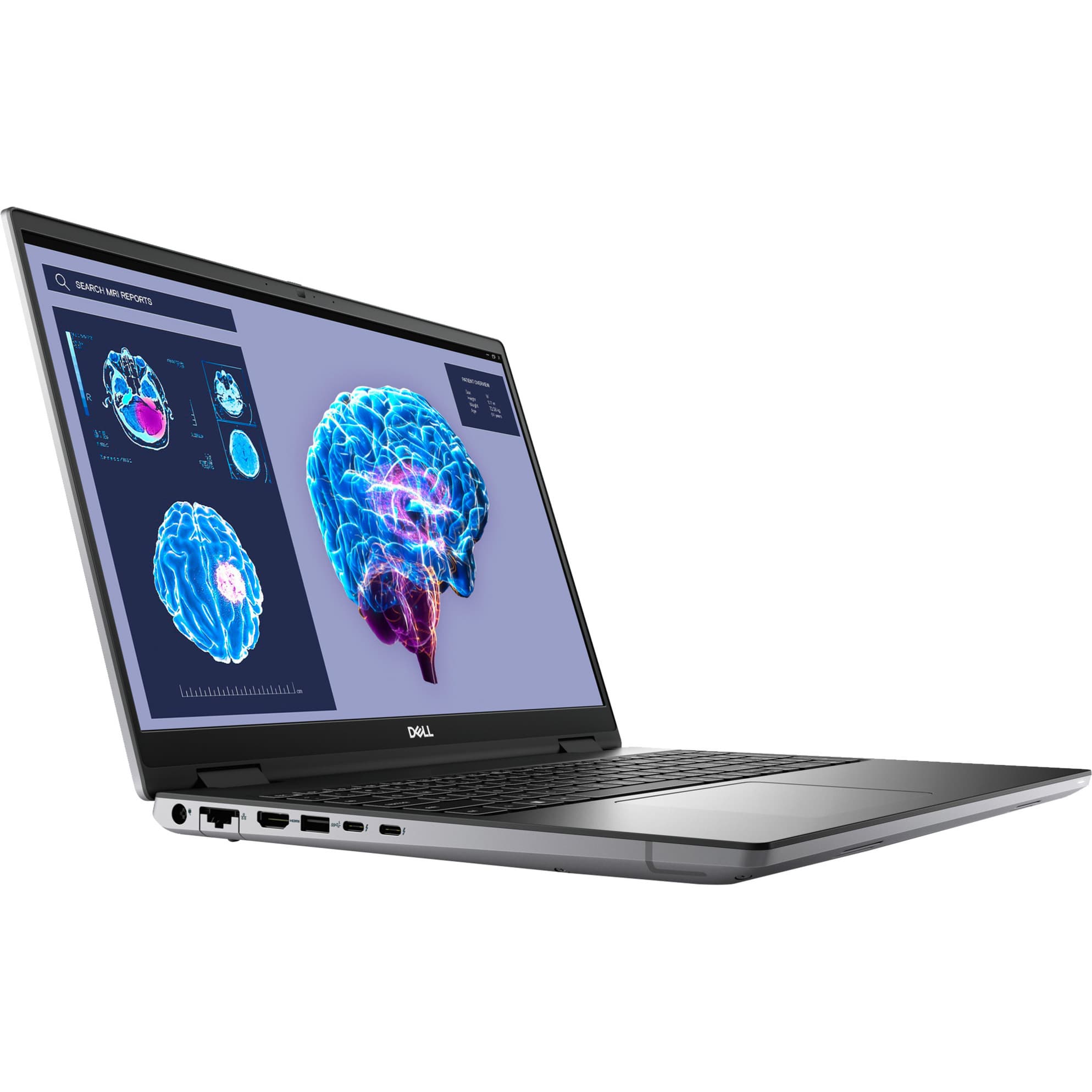 Precision 7680-MVHK0, Notebook – Bild 1