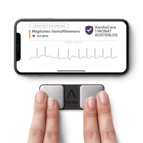 kardiamobile 1k ekg monitor